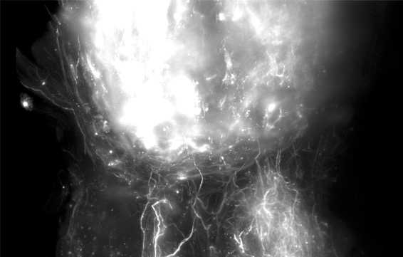 Humanizing spinal cord regeneration