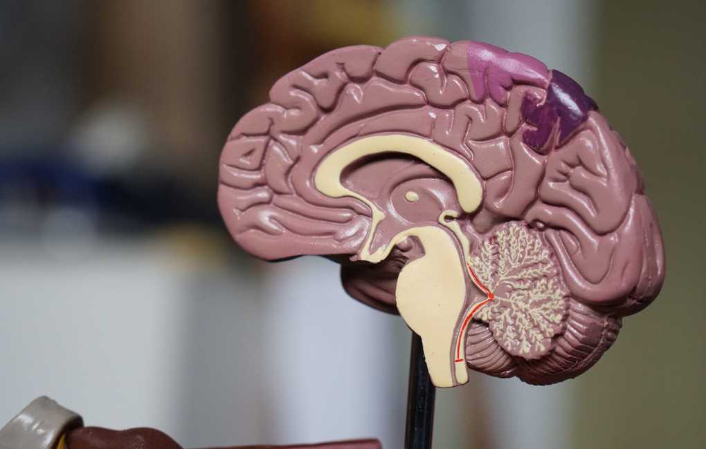 Utveckling hos barn med risk för cerebral pares